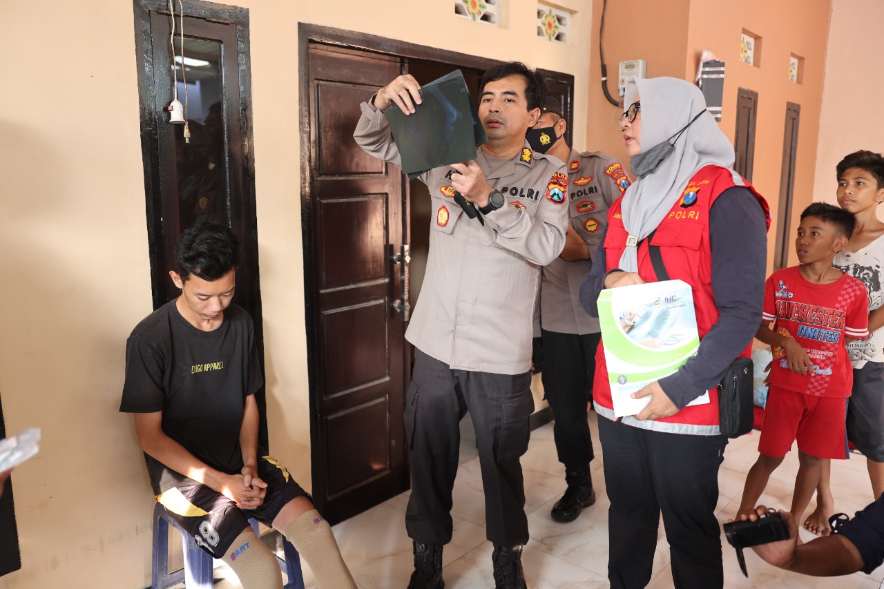 BidDokkes Polda Jatim Turunkan Dokter Spesialis Mata dan Bedah untuk Pantau dan Rawat Korban Tragedi Kanjuruhan